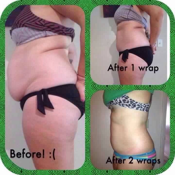 Get Distributor Prices On All Weight Loss Body Contouring Skinny Wraps 90 Day Challenge 