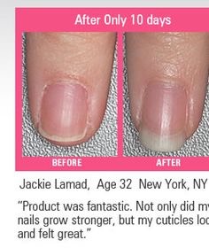 Nail Growth Faster 💅😱👍💯