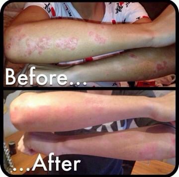 Want Healthy Hair, Skin And Nails?