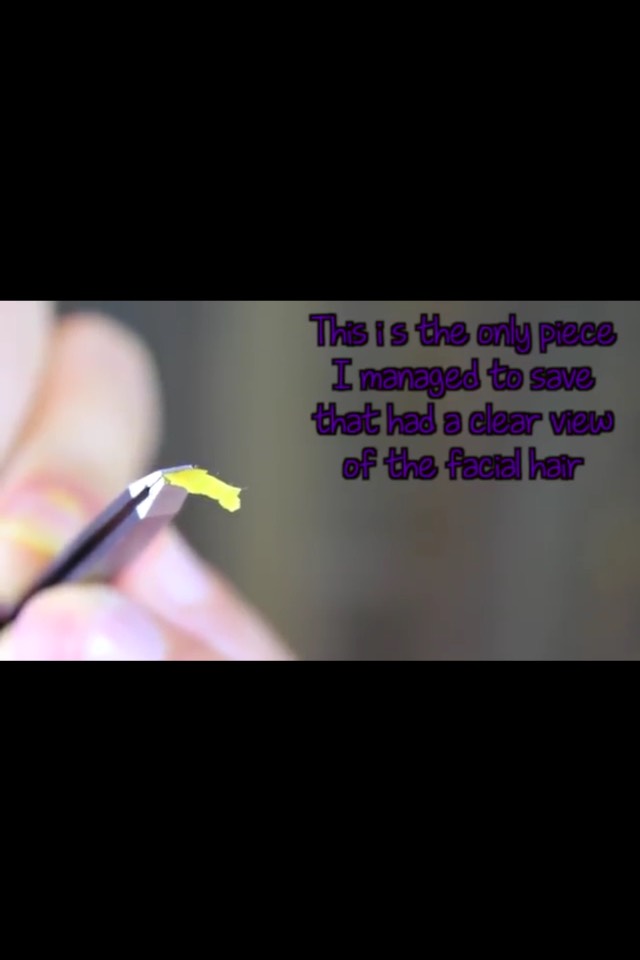 Remove Facial Hair Naturally