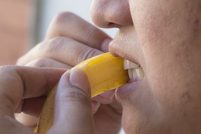 Take the inside of your orange or banana peel and rub it against your teeth for 5 minutes every day for 2 weeks!