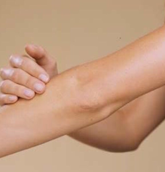 Rubbing Vaseline into your elbows can help heel them if they are dry.