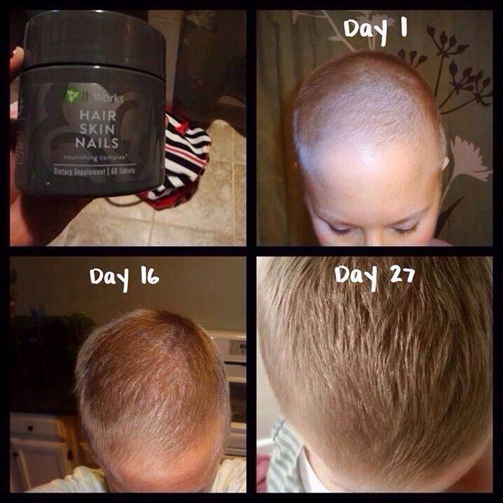 Easy Way To Grow Hair Back Fast