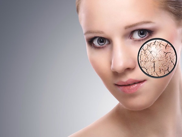 Beauty tips for dry skin
If you think that oily skin is a pain, then let us tell you that having dry skin isn’t a walk in the park either. Dry skin gets very uncomfortable especially in the winters and in extreme cold temperatures giving intense pain and unsightly appearance when not taken care of