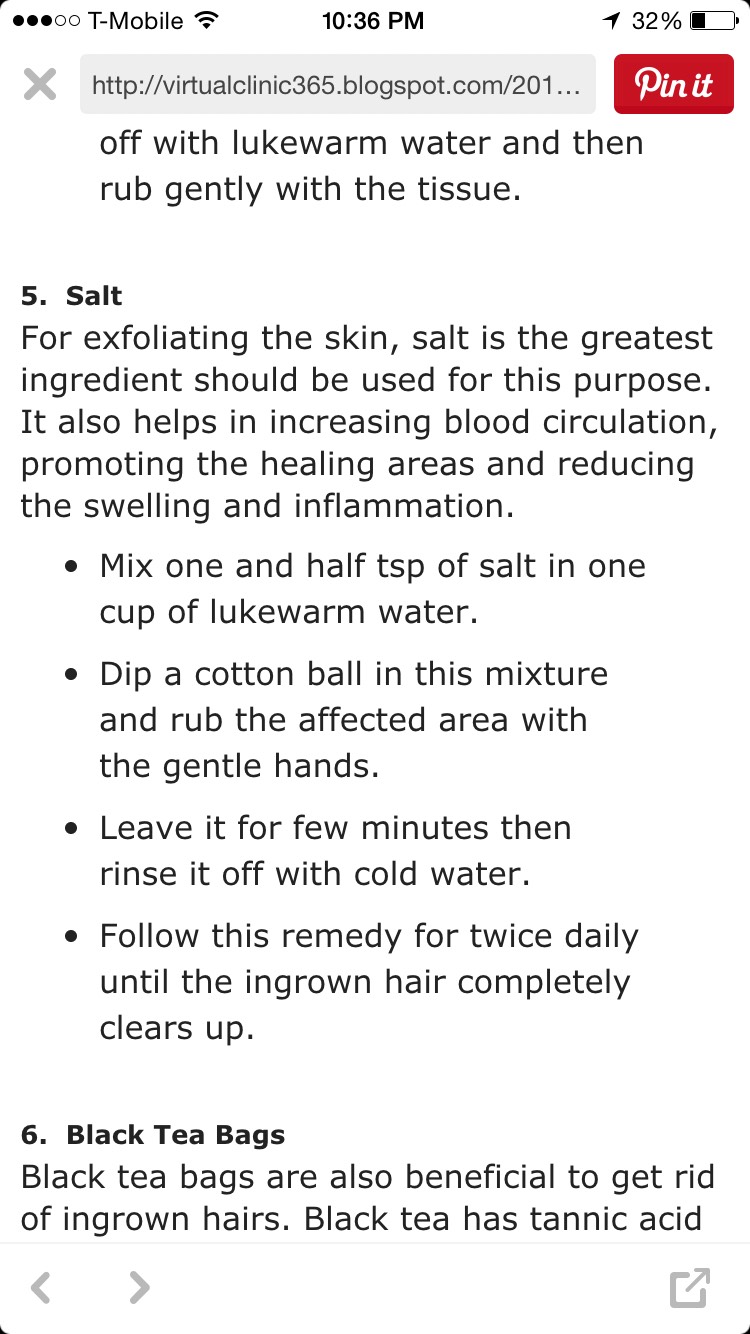 How To Get Rid Of Ingrown Hair! 