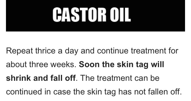 Home Remedies To Remove Skin  Tags 