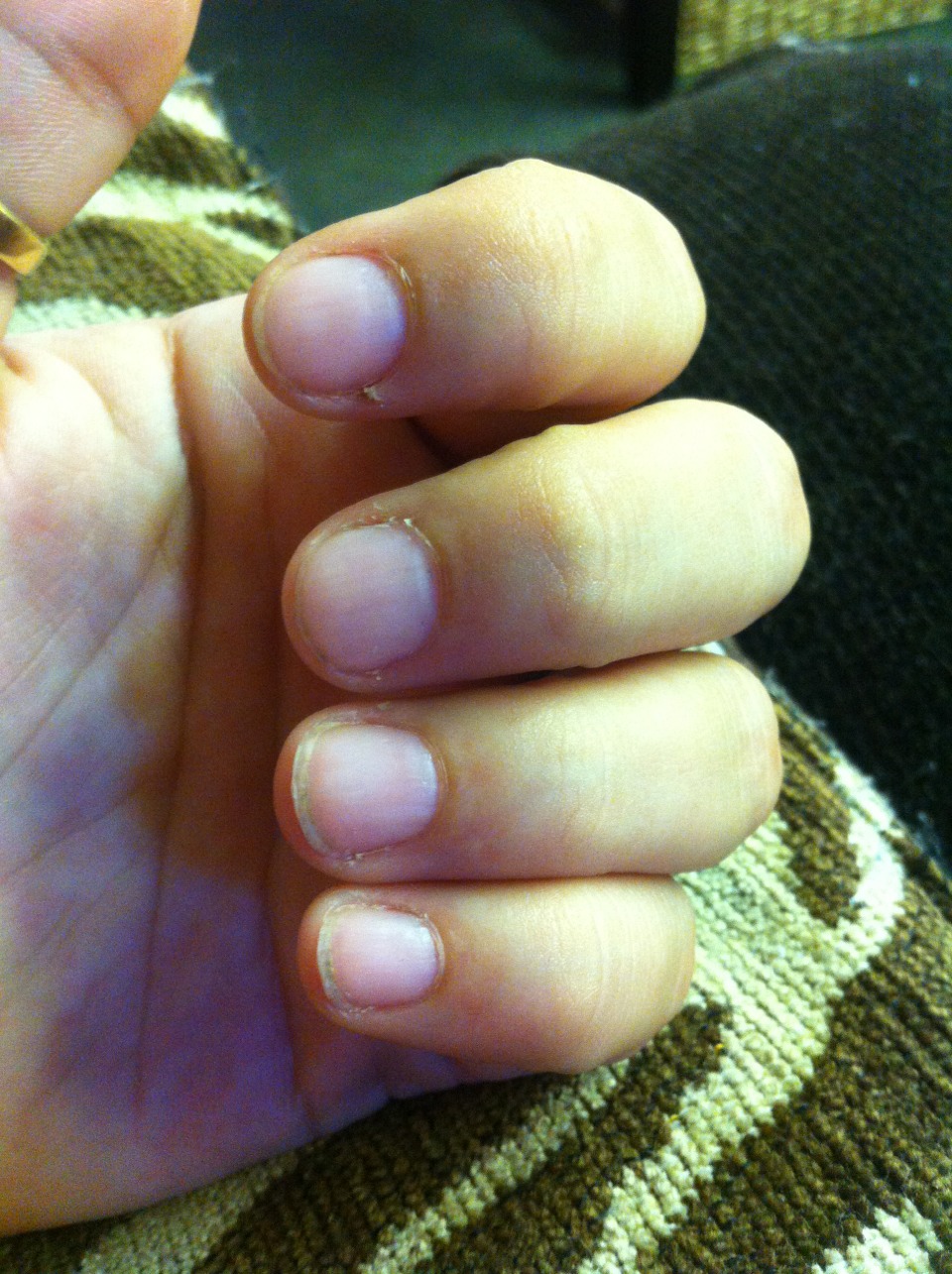 Before nails