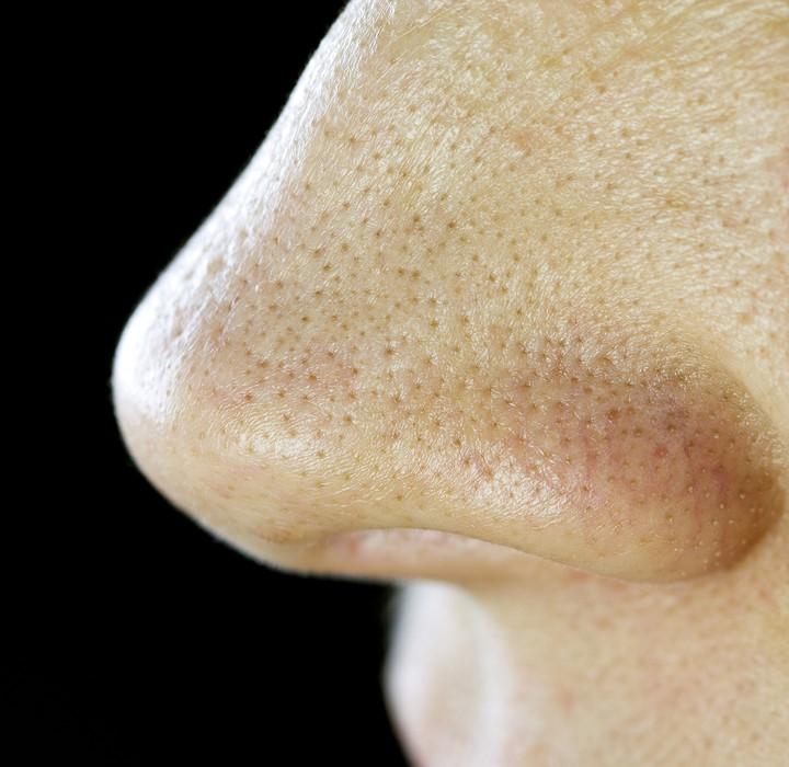 Blackhead treatment: It may sound too good to be true, but because lemons are antibacterial, they can help treat acne. Just slice a lemon, and squeeze the juice on your face. Your blackheads will start to fade before you know it.