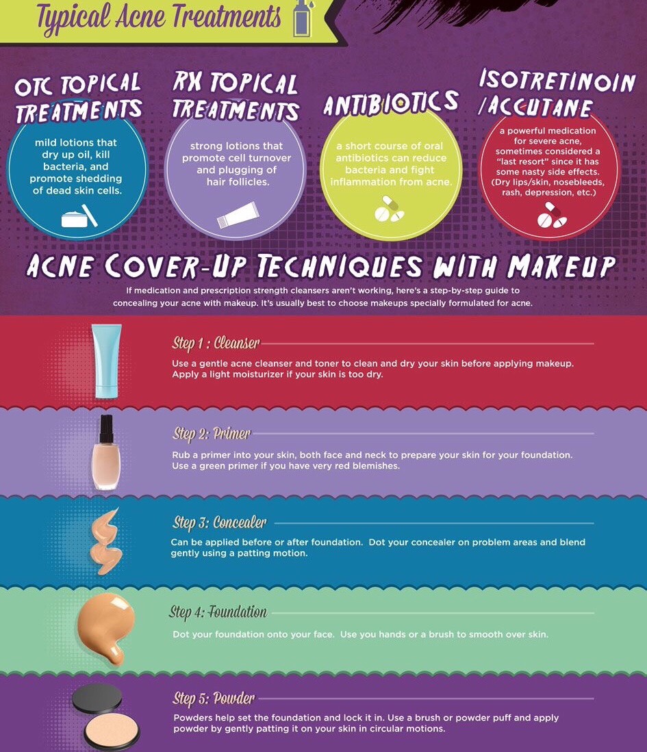 Natural Acne Treatment 
