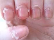 6.) Cuticle oil: If your nail beds have been looking a bit dry and ragged, just dab some coconut oil on them.  Do this before bed and put on gloves – you’ll wake up to soft, smooth digits 