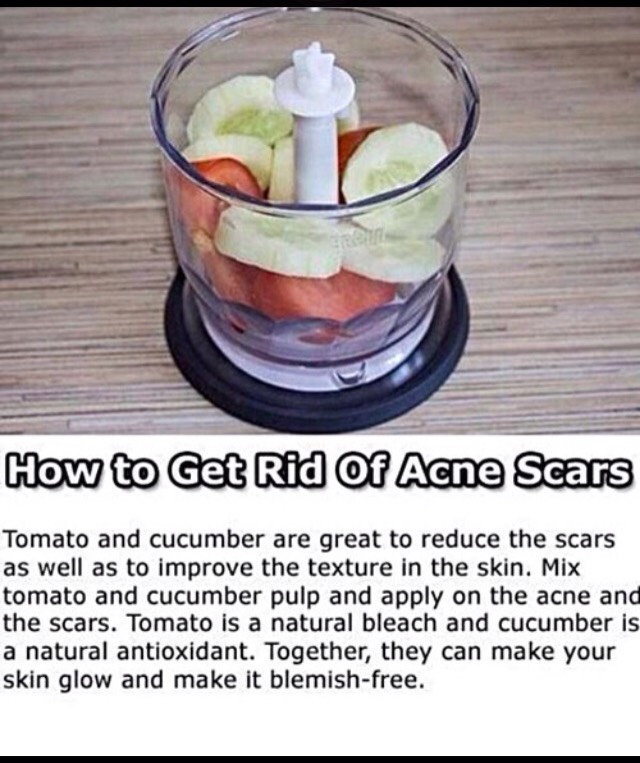 How To Get Rid Of Acne Scar 😱👍💯