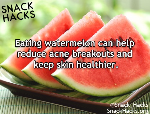 😋Snack Hacks Anyone?🍭