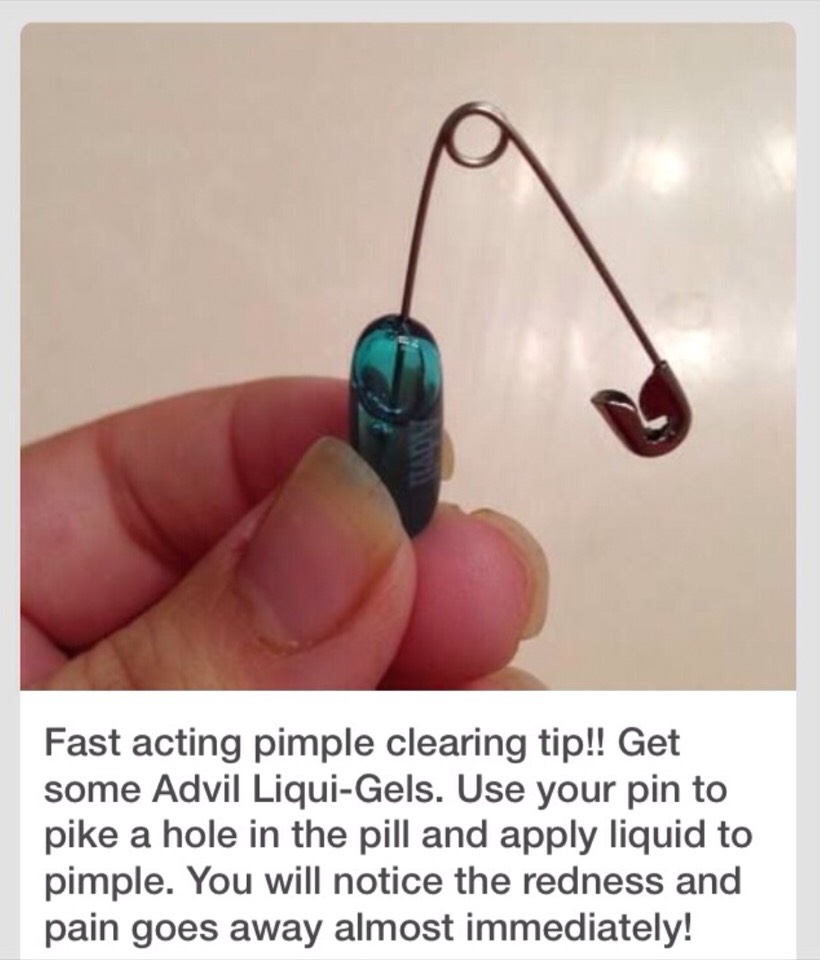 Fast Acting Pimple Clearing Tip!! 😃👍🏻💯