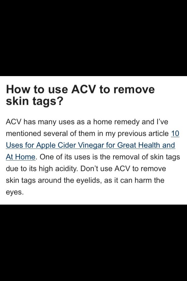 How To Remove Skin Tags And Warts Naturally And Cheaply At Home
