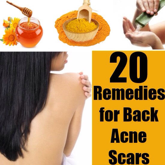 How To Get Rid Of Body Acne💕✨👍❤️