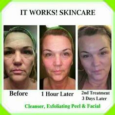 hate acne ? Don't you just hate those blemishes? itworks products will do just the work