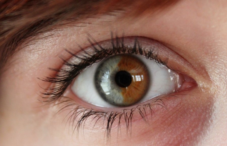 Brown eyes are actually blue, underneath a brown pigment, and so there is a laser procedure that is able to turn brown eyes blue permanently.