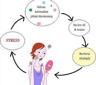 8. What causes acne?
"The cause of acne is unknown," Dr. Day says, "but we do know what makes it worse." These factors include your hormones being out of balance, stress, and a specific bacteria that lives deep in your pores called Propionibacterium acnes, which feeds off the oil your sebaceous glands produce. Sure, not washing your face at night or using dirty makeup brushes can contribute to breakouts, but the aforementioned factors are known to make acne worse.