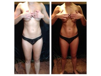 The secret is all in the application. A self-tan application will naturally contour the body and make you appear to be slimmer and more toned. 