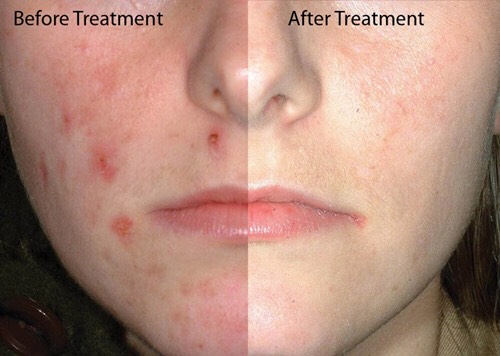 After a few weeks you should see a big difference. Trust me!!😉