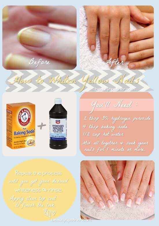 If you don’t want to bother getting a full manicure (and who does?) you can simply clean up your nails with this simple recipe