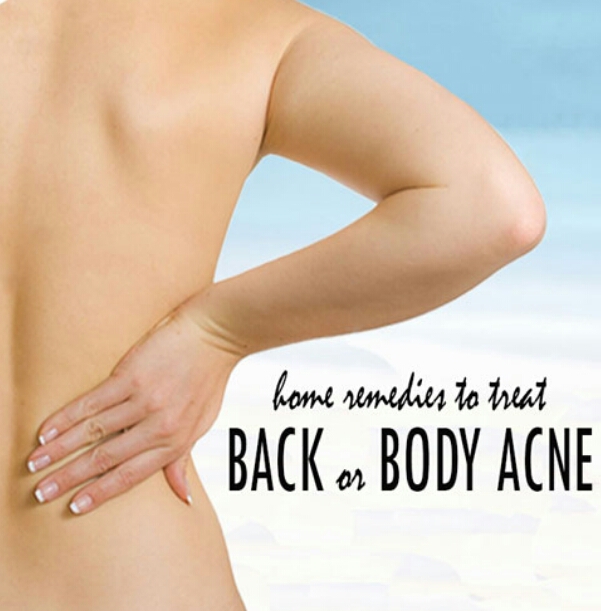 PISTOFF ITCHING BACK & FRONT BODY ACNE IRRITATion:getrid of it#tipit
