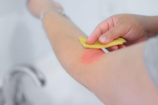 SOOTHE A RASH

Got poison ivy? Rub the banana peel over the area to soothe and cool your skin.