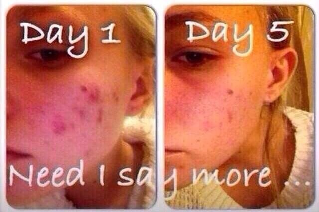 Want Clear Skin, Longer Hair And A Healthy Lifestyle?