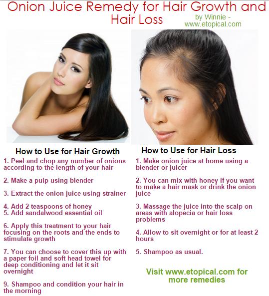Onion Juice Remedy For Hair Growth & Hair Loss!!!
