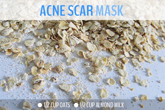 10 Vegan Beauty Hacks! 