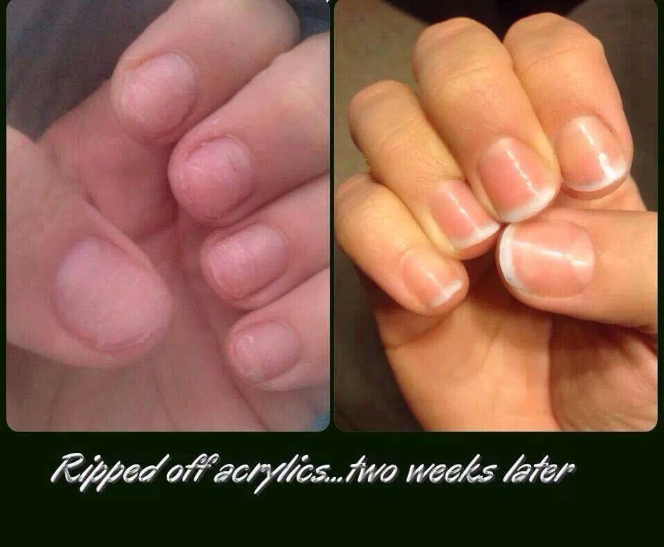 Wow!!!!! Do I need to say more :) 
http://trishtightentone.myitworks.com