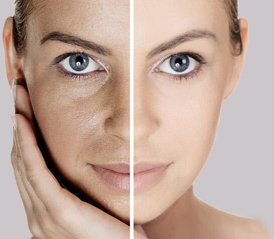 10. To lighten age spots when rubbed directly on the skin.