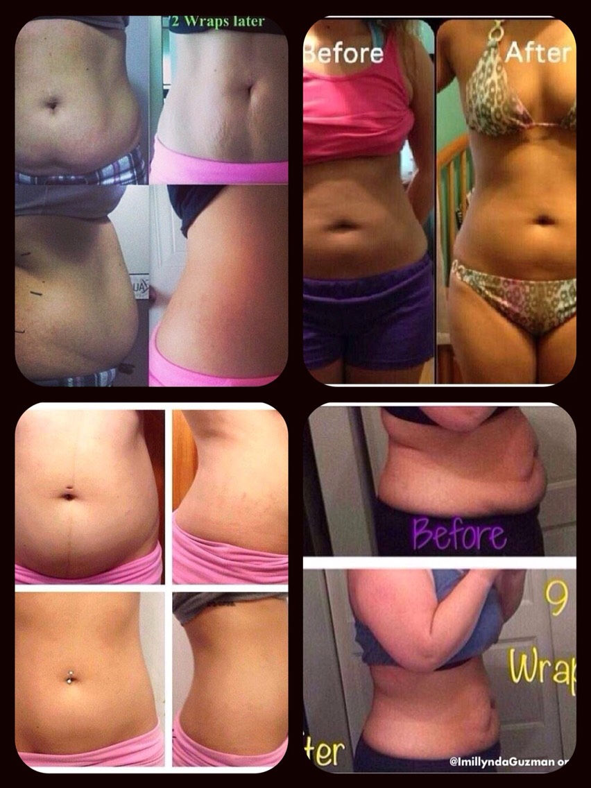 These wraps do amazing things! Try one for free!! GOOD LUCK!! 🍀