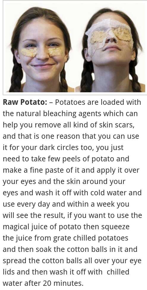 GET RID OF SKIN SCARS & DARK CIRCLES  VID 4 LOADED TIPS*♡*